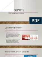 Diapositivas Gingivitis