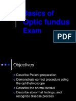 Basics of Fundus