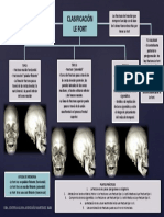 Clasificacion Le Fort