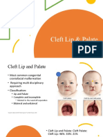 Cleft Lip & Palate