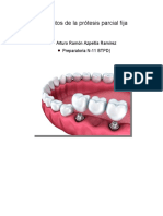 Elementos de La Prótesis Parcial Fija