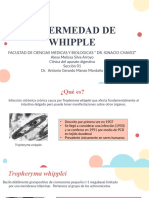 Enfermedad de Whipple