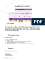 Sinus Bradycardia