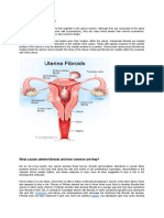 What Are Uterine Fibroids