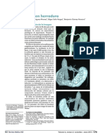 Riñon en Herradura PDF