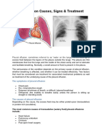 Pleural Effusion Causes, Signs & Treatment