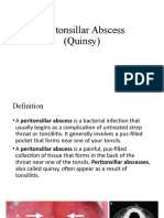 Peritonsillar Abscess (Quinsy)