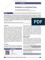 Prosthetic Rehabilitation of An Amputated Finger: Case Report