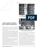 Acu Accident Lumbar