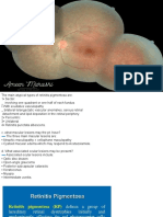 Retinitis Pigmentosa