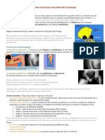 Luxation Et Fracture-Luxation de La Hanche