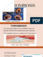 THROMBOSIS