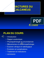 04 Calcanéus Fractures Usb