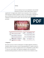 Caso Clínico Periodoncia