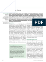 Cholangiocarcinoma: Seminar