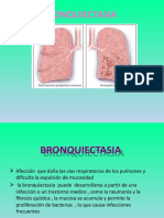 BRONQUIECTASIA