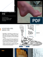 Patologias Mas Frecuentes Del Medio Pie