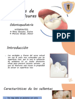 Monografia - Sellantes de Fosas y Fisuras