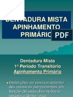 Apinhamento