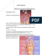 Artritis Reumatoidea-Osteoartrosis