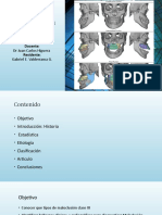 Maloclusión Clase III (Autoguardado)