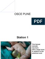 Osce Pune