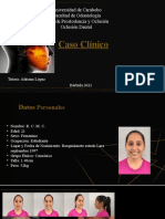 Caso Clinico Oclusion Dental