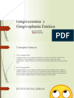 TEMA 5. Gingivectomia y Gingivoplastia Estética