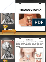 TIROIDECTOMIA