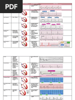 Rhythm Description Schematic Diagram Egc Characteristics Sample Trace