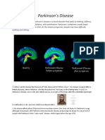 Parkinson's Disease