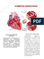 Endocarditis Infecciosa