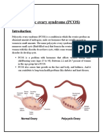 Assignment: Polycystic Ovary Syndrome (PCOS)