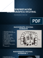 Interpretación Radiográfica Oclusal