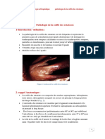 Pathologie de La Coiffe Des Rotateurs