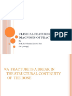 Clinical Features and Diagnosis of Fractures