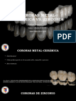 Coronas Metal-Cerámica Vs