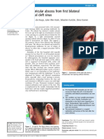 Retroauricular Abscess Case Report