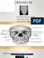 Proyeccion de Craneo Ap