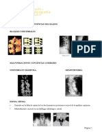Malformacione Congénitas Del Raquis