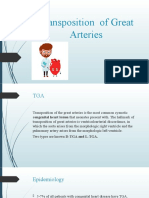 Transposition of Great Arteries