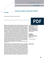 Carcinoma Papilar de Tiroides - Variante de Células Altas - Reporte de Caso