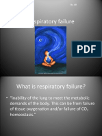 Respiratory Failure: by Ar