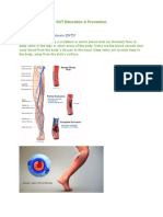 DVT Prevention Education