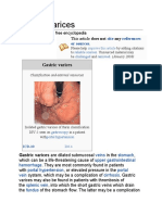 Gastric Varices