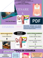 Copia de Ultimo Cesarea