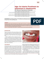 Maryland Bridge: An Interim Prosthesis For Tooth Replacement in Adolescents