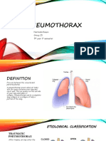 Pneumothorax: Narmada Kasuni Group 25 5 Year 1 Semester