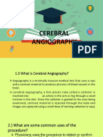 Dsa Cerebral Angiography