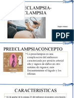 Preeclampsia y Eclampsia